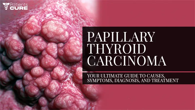 papillary-thyroid-carcinoma-causes-symptoms-treatment